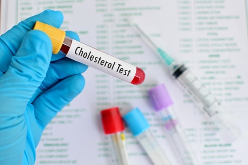 Chỉ số cholesterol trong xét nghiệm mỡ máu