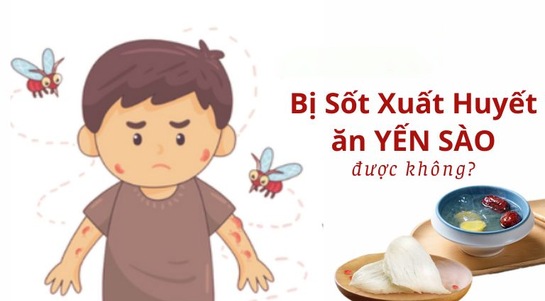 Sốt xuất huyết ăn yến được không là câu hỏi được nhiều người quan tâm