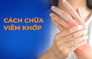 Tìm Hiểu Các Cách Chữa Viêm Đa Khớp Hiệu Quả, An Toàn