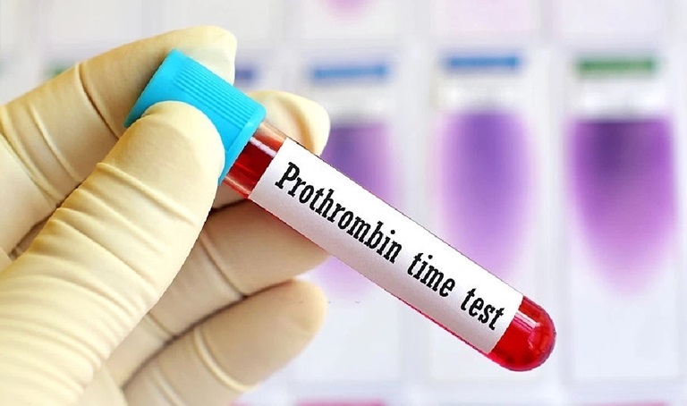 Prothrombin Time (PT) được sử dụng để đánh giá chức năng tổng hợp của gan