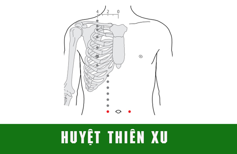 Huyệt Thiên Xu nằm ngang rốn 2 thốn, hai bên rốn