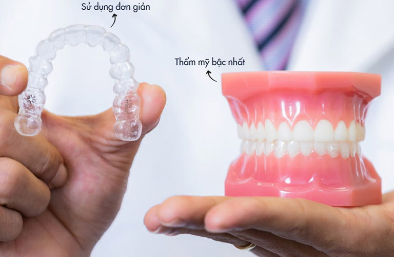 Niềng răng Invisalign đảm bảo tính thẩm mỹ cao